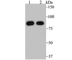 RRM1 Rabbit anti-Human, Mouse, Clone: JB09-43, Novus Biologicals 100 &mu;l;